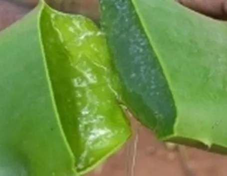 Gel-Aloe-Vera