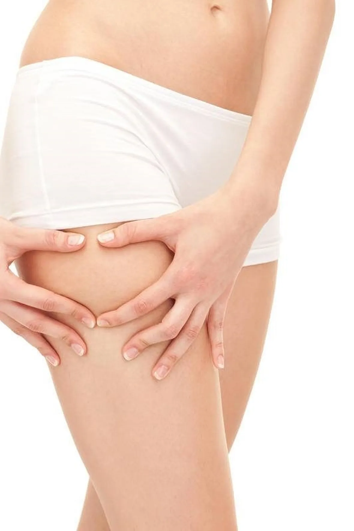 Si stima che l'80% della popolazione femminile soffra di cellulite